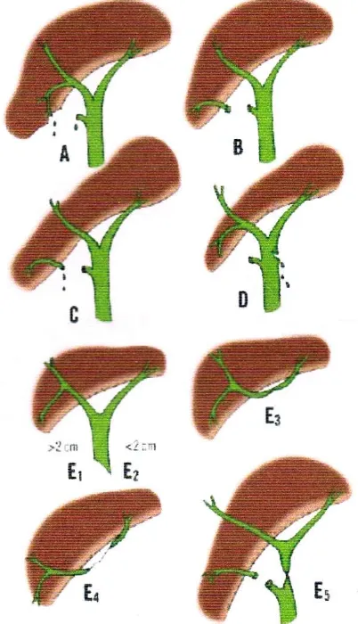 Fig. 4. Stewart-Way Classification 