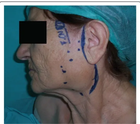 Figure 3 The surgical specimen.