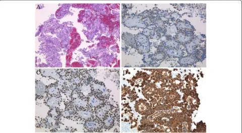 Figure 6 Macroscopic images of the specimen.the resected specimen revealed a solid tumor extending to the tail of Our examination ofthe pancreas