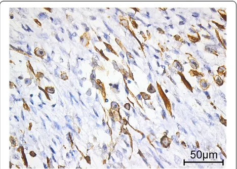 Figure 5 Immunohistochemical staining of desmin (originalmagnification x 40).