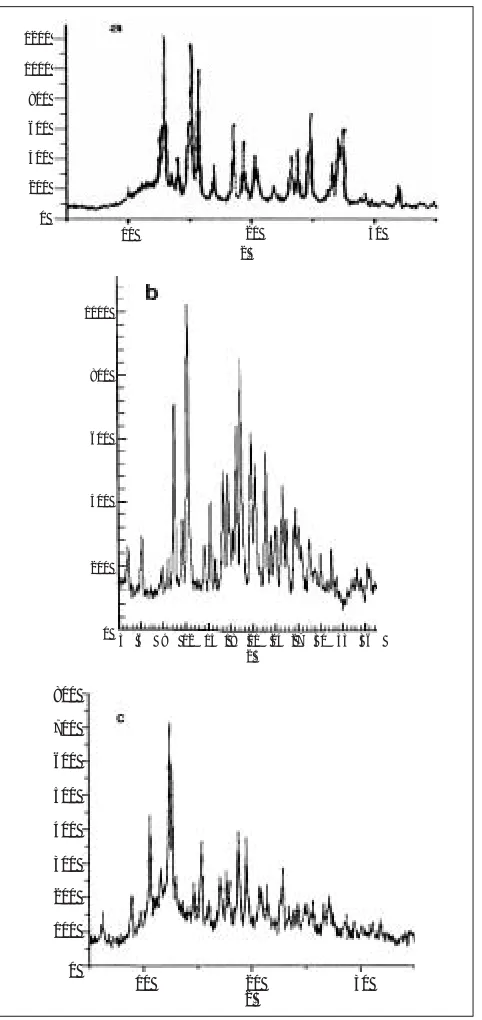 Fig. 2: Powder X-ray diffractograms.
X-ray diffraction patterns of carbamazepine (a), βββββ cyclodextrin(b), and Solid complexes (c).
