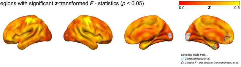 Figure 2-3. Z-transformed F-statistics of brain regions that are significantly 