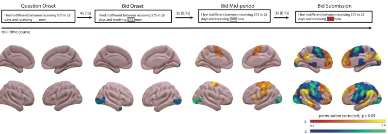 Figure 3-1 .Whole brain effects correlated with participants’ bid response on each 