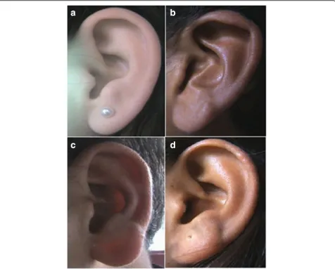 Fig. 2 Photographs showing the shape of the ear. a Oval. b Triangular. c Rectangular. d Round