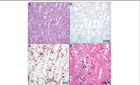 Figure 3 Positron emission tomography scan at diagnosis of lymphoma and at completion of therapy.