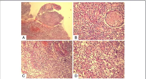 Figure 1 Gross appearance of the neck lesion at presentation (A) and after cyclophosphamide, doxorubicin, vincristine, prednisone,and rituximab (CHOP + R) therapy (B).