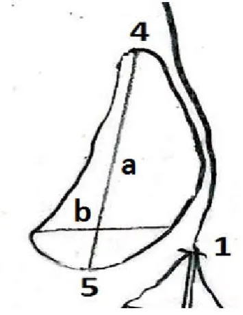 Figure 1. Various cephalometric landmarks that are required for the tracing of lateral cephalogram