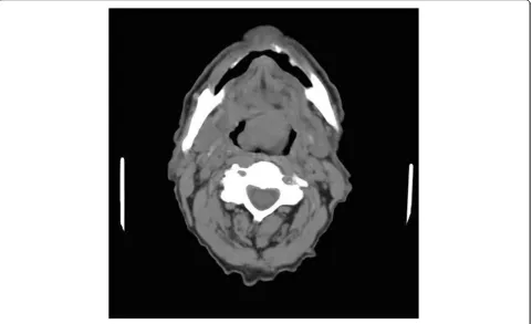 Figure 1 Computed tomography image demonstrating the mass.