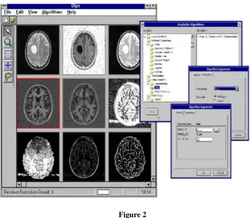Figure 2 The basic requirement that distributed image processing is readily implemented on various operating systems 