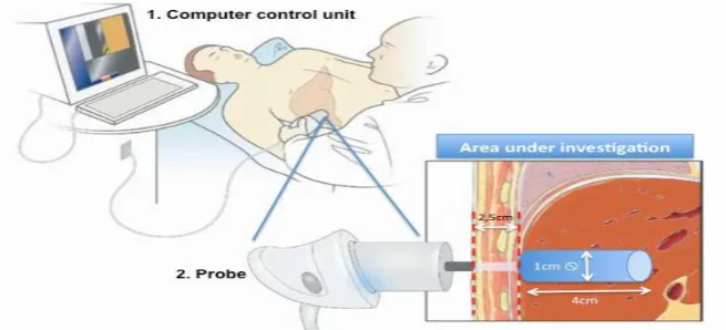 Figure 1 Illustration of the two different constituent of the measuring instrument and the positioning of the probe in relation to the area of liver under investigation