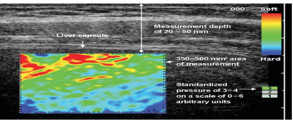 Figure 2 Example of tissue elasticity distribution in a healthy subject represented as color-coded images over conventional B-mode image [17]