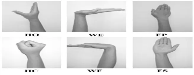 Figure 2: Electrodes placement on the right forearm 