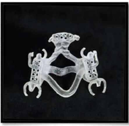 Figure 8. Photopolymer resin framework 