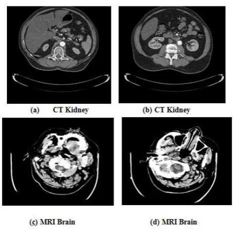 Figure 6.For analysis purpose, 100 normal and 80 abnormal images are taken for training