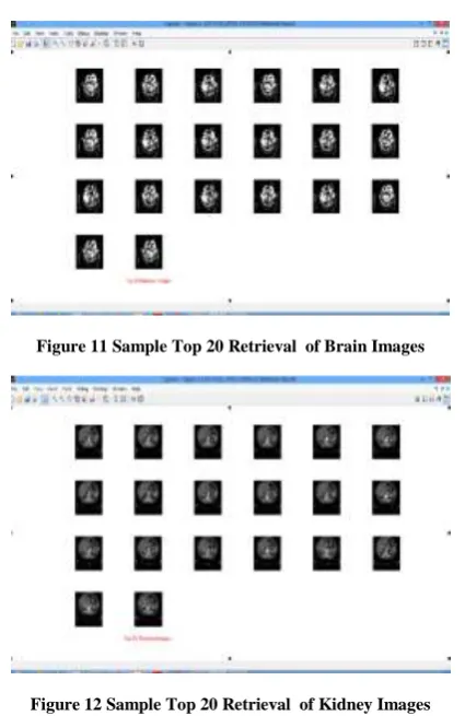 Figure 11 Sample Top 20 Retrieval  of Brain Images   