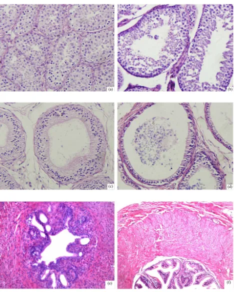 Figure 1. Histological changes of the testis, epididymis and vas deferens of two groups