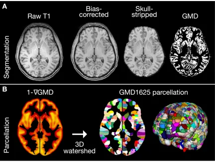 Figure 2.1 T1 preprocessing and high-resolution gray matter parcellation. A, Raw T1 MPRAGE volumes were ﬁrst corrected for ﬁeld inhomogeneity and then skull stripped by transforming the MNI brain mask to native space