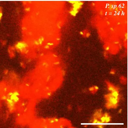 Figure 2.5. Image of Pseudomonas sp. 62 in 2 wt% casein, 0.08 wt% xanthan solution 20 μm above coverslip
