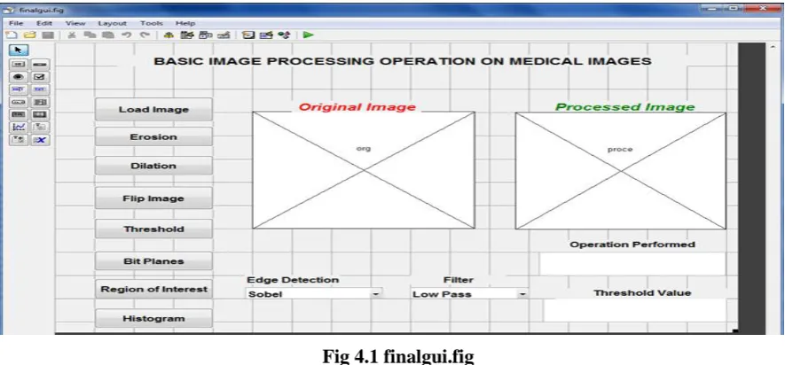 Fig 4.1 finalgui.fig 
