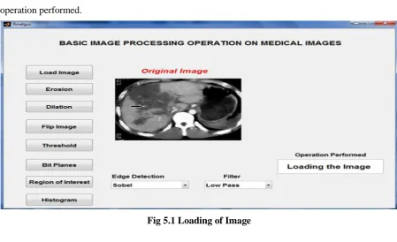 Fig 5.1 Loading of Image 