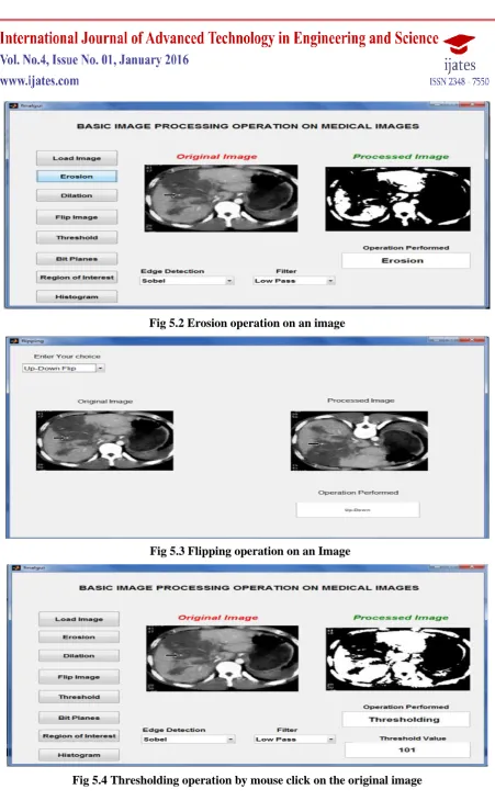 Fig 5.4 Thresholding operation by mouse click on the original image 