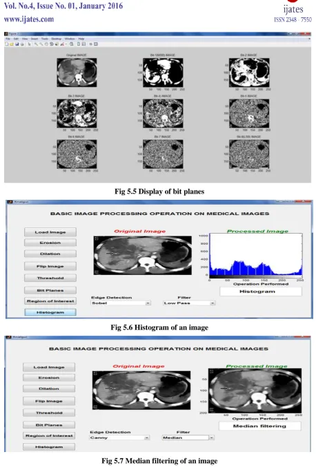Fig 5.7 Median filtering of an image 