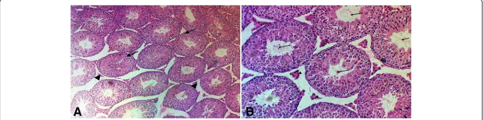 Fig. 2 Photomicrograph of the testis section stained with hematoxylin and eosin from the malathion group under the study.with no identifiable sperm in the lumens