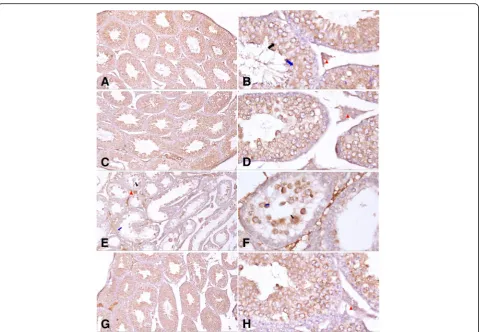 Table 4 Percent area (%) stained by Bcl-2 and Caspase3 immunoreaction of the testis in mice after 4 weeks of exposure tocurcumin (200 mg/kg/day), malathion (27 mg/kg bw), and their combination