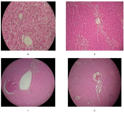 Figure 1 triaditis.  (D): Hepatocytes of the methanol 250mg pretreated group showed minimal inflammation with moderate portal triaditis and their lobular lobular architecture was normal.(C): Hepatocytes of the Silymarin pretreated group showed normal hepat