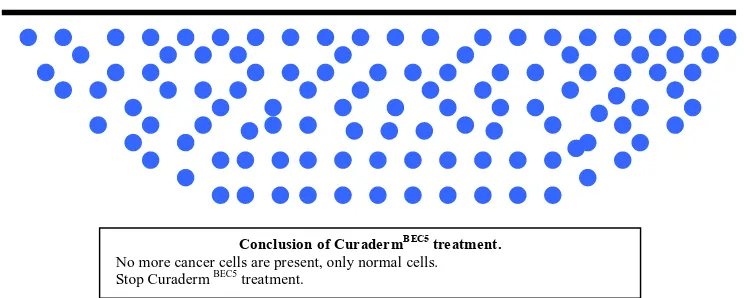 Figure 12 shows an actual clinical representation of the sequential events of a skin cancer (squamous cell carcinoma) treatment with CuradermBEC5 [38]