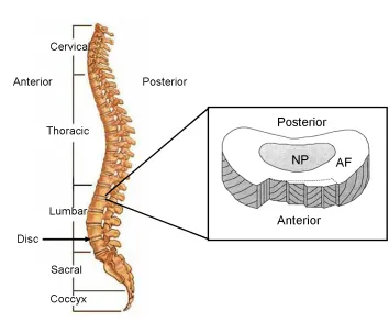 Figure 2-1: A) Five regions of the spine. B) Schematic of the intervertebral disc showing the annulus fibrosus (AF) and nucleus pulposus (NP)