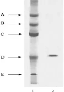 Figure 1. Ion exchange chromatography on QAEIon exchange chromatography on QAE-Sephadex of  the ammonium sulphate fractionthe ammonium sulphate fraction 
