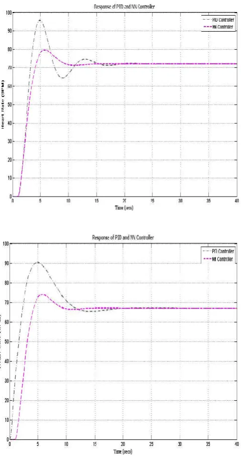 Figure 4. Response of PID and NN controller for 67 and 72 bpm 