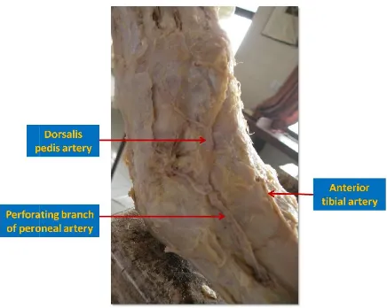 Figure 1. Abnormal course of Dorsalis pedis artery Figure 1. 
