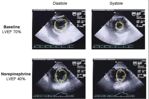 Table 2 Incidence of LV systolic dysfunction in septic shock according to the time of evaluation