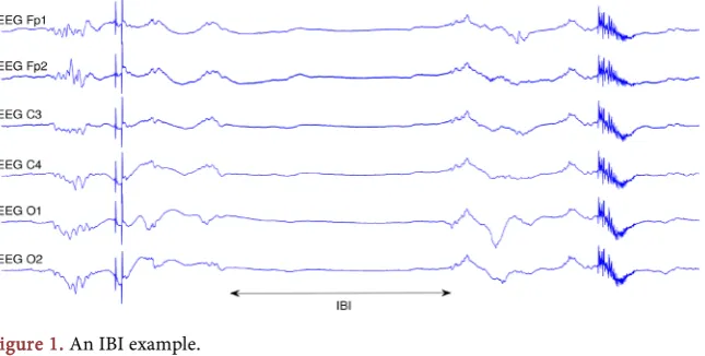 Figure 1. An IBI example. 