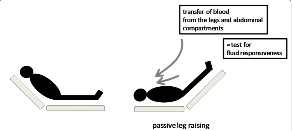 Figure 4 Passive leg raising. The passive leg raising test consists in measuring the hemodynamic effects of a leg elevation up to 45°
