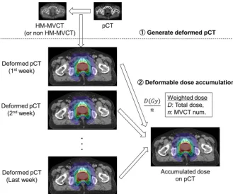 Figure 2. The procedure of deformable image registration combined with the HM me-image-processing method adjusts HU values between pCT and MVCT images by using image cumulative histograms of HU values, generating an HM-MVCT (a)