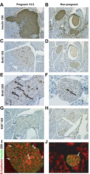 Figure 2.2: Histological analysis of β-cell proliferation, hypertrophy, and mass at 