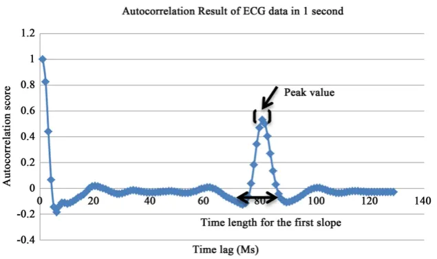 Figure 3. Proposed automatic mechanism to detect arrhythmia symptom. 