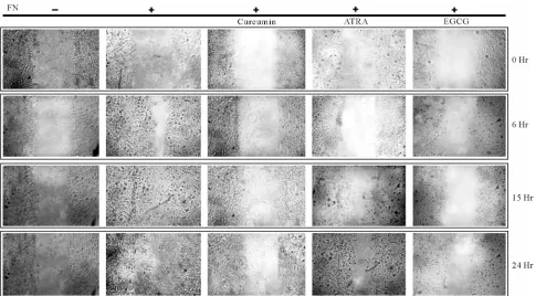 Figure 7. Effect of the natural products on cell migration: MDA-MB-231 cells were plated in such a cell density that it form conflu- grown in SFCM in absence (C) or in presence of natural products (Curcumin, ATRA, EGCG) for 24 hr