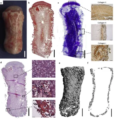 Fig. 4. Anatomically shaped phalanx constructs, consisting of an osseous component comprising an MSC-encapsulated alginate hydrogel and a chondral componentcomprising self-assembled chondrocytes, generated through spatial regulation of endochondral ossiﬁca