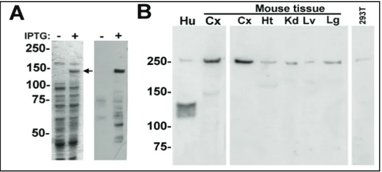 Figure 1-3. Biochemical characterization of LRRK2 protein in human and mouse tissue. (A) (Left) (~145kDa) as indicated by the arrow