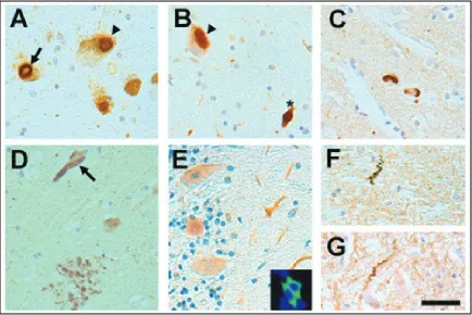 Figure 1-4. Histological characterization of patients with LRRK2 mutations. (A, B) Staining for alpha-