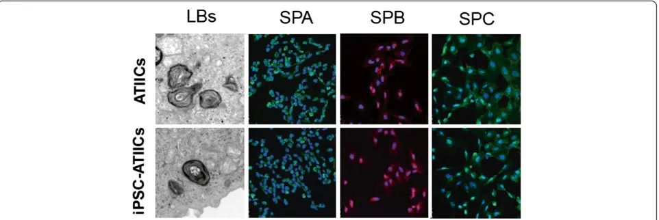 Figure 1 Diagram of hiPSC differentiation. The hiPSCs were cultured on matrigel-coated plates in DM containing 20 μg/ml of G418 for 14 days.The SPC positive cells were observed in the differentiating cultures at a very early time point (day 5), and can be 