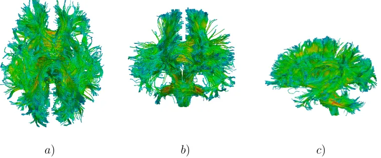 Figure 2.4:Whole-brain tractography uses all points in the white matter as seedsfor ﬁber tracking