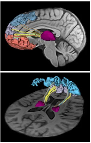 Figure 3.3: Thalamo-cortical connectivity models for the prefrontal lobe are createdusing deterministic tractography in a subject-speciﬁc atlas
