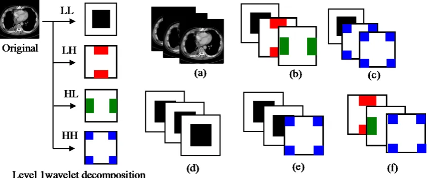 Figure 2. Original image and four decomposed images at level 1, obtained by redundant discrete wavelet transform using Daubechies db2 basis function