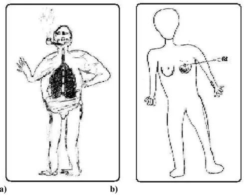 Figure 8.a) Phase I -Representation of lung cancer caused by tobacco in a SF – drawn by a male student