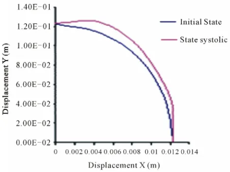 Figure 8. Constraints values σy applied on elements 1, 2, 3, 4 according to blood pressure